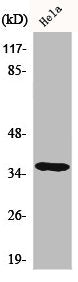 Western Blot analysis of HeLa cells using Casein Kinase Iα Polyclonal Antibody