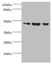 Western blot All lanes: Actin-like protein 6B antibody at 3ug/ml Lane 1: Hela whole cell lysate Lane 2: U251 whole cell lysate Lane 3: HepG2 whole cell lysate Secondary Goat polyclonal to rabbit IgG at 1/10000 dilution Predicted band size: 47 kDa...