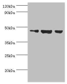 Western blot All lanes: Actin-like protein 6B antibody at 3ug/ml Lane 1: Hela whole cell lysate Lane 2: U251 whole cell lysate Lane 3: HepG2 whole cell lysate Secondary Goat polyclonal to rabbit IgG at 1/10000 dilution Predicted band size: 47 kDa...