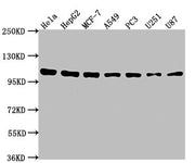 Western Blot Positive WB detected in: Hela whole cell lysate, HepG2 whole cell lysate, MCF-7 whole cell lysate, A549 whole cell lysate, PC3 whole cell lysate, U251 whole cell lysate, U87 whole cell lysate All lanes: ACTN1 antibody at 1:2000 Second...
