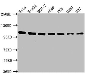 Western Blot Positive WB detected in: Hela whole cell lysate, HepG2 whole cell lysate, MCF-7 whole cell lysate, A549 whole cell lysate, PC3 whole cell lysate, U251 whole cell lysate, U87 whole cell lysate All lanes: ACTN1 antibody at 1:2000 Second...