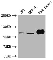 Western Blot Positive WB detected in: 293 whole cell lysate, MCF-7 whole cell lysate, Rat Heart tissue All lanes: ACTN2 antibody at 1:2000 Secondary Goat polyclonal to rabbit IgG at 1/50000 dilution Predicted band size: 104 kDa Observed band size:...