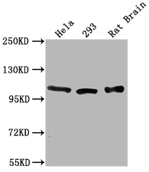 Western Blot Positive WB detected in: Hela whole cell lysate, 293 whole cell lysate, Rat Brain tissue All lanes: ACTN2 antibody at 1:2000 Secondary Goat polyclonal to rabbit IgG at 1/50000 dilution Predicted band size: 104 kDa Observed band size:...