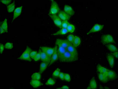 Immunofluorescence staining of Hela cells with CSB-PA001243LA01HU at 1:133, counter-stained with DAPI. The cells were fixed in 4% formaldehyde, permeabilized using 0.2% Triton X-100 and blocked in 10% normal Goat Serum. The cells were then incubat...