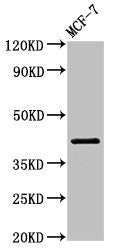 Western Blot Positive WB detected in: MCF-7 whole cell lysate All lanes: ACTR1A antibody at 1µg/ml Secondary Goat polyclonal to rabbit IgG at 1/50000 dilution Predicted band size: 43 kDa Observed band size: 43 kDa