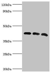 Western blot All lanes: Alpha-centractin antibody at 8ug/ml Lane 1: Mouse brain tissue Lane 2: MCF-7 whole cell lysate Lane 3: Mouse liver tissue Secondary Goat polyclonal to rabbit IgG at 1/10000 dilution Predicted band size: 43 kDa Observed band...