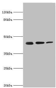 Western blot All lanes: Actin-related protein 2 antibody at 3ug/ml Lane 1: Mouse spleen tissue Lane 2: Jurkat whole cell lysate Lane 3: MCF-7 whole cell lysate Secondary Goat polyclonal to rabbit IgG at 1/10000 dilution Predicted band size: 45, 46...