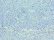 Immunohistochemistry of paraffin-embedded human tonsil tissue using CSB-PA001248ESR2HU at dilution of 1:100
