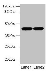 Western blot All lanes: ACTRT2 antibody at 6µg/ml Lane 1: HepG2 whole cell lysate Lane 2: A431 whole cell lysate Secondary Goat polyclonal to rabbit IgG at 1/10000 dilution Predicted band size: 42 kDa Observed band size: 42 kDa