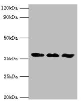 Western blot All lanes: ACVR1 antibody at 6ug/ml Lane 1: A549 whole cell lysate Lane 2: HepG2 whole cell lysate Lane 3: Mouse gonad tissue Secondary Goat polyclonal to rabbit IgG at 1/10000 dilution Predicted band size: 39 kDa Observed band size:...