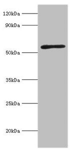 Western blot All lanes: Activin receptor type-2A antibody at 3ug/ml + Mouse brain tissue Secondary Goat polyclonal to rabbit IgG at 1/10000 dilution Predicted band size: 58, 46 kDa Observed band size: 58 kDa