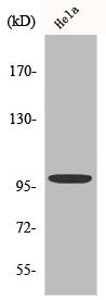 Western Blot analysis of HeLa cells using Catenin-α E/N Polyclonal Antibody