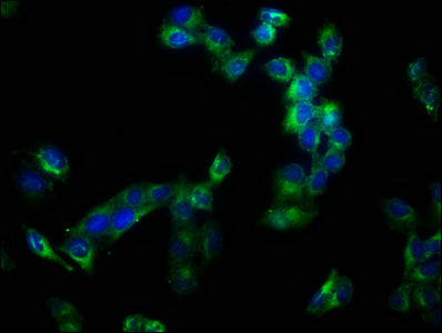 Immunofluorescence staining of Hela cells with CSB-PA001273LA01HU at 1:133, counter-stained with DAPI. The cells were fixed in 4% formaldehyde, permeabilized using 0.2% Triton X-100 and blocked in 10% normal Goat Serum. The cells were then incubat...
