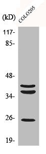 Western Blot analysis of COLO205 cells using Cathepsin B Polyclonal Antibody