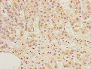 Immunohistochemistry of paraffin-embedded human adrenal gland tissue using CSB-PA001297LA01HU at dilution of 1:100
