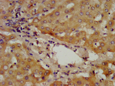 IHC image of CSB-PA001301LA01HU diluted at 1:400 and staining in paraffin-embedded human liver tissue performed on a Leica BondTM system. After dewaxing and hydration, antigen retrieval was mediated by high pressure in a citrate buffer (pH 6.0). S...