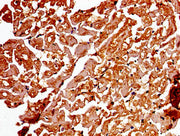 Immunohistochemistry of paraffin-embedded human heart tissue using CSB-PA001311LA01HU at dilution of 1:100