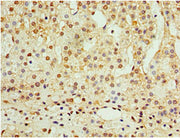 Immunohistochemistry of paraffin-embedded human adrenal gland tissue using CSB-PA001322DSR1HU at dilution of 1:100