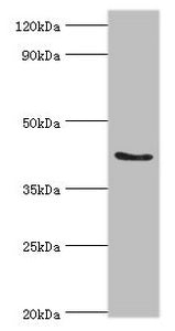 Western blot All lanes: ADAP1 antibody at 2µg/ml + Rat brain tissue Secondary Goat polyclonal to rabbit IgG at 1/10000 dilution Predicted band size: 44, 45, 36 kDa Observed band size: 44 kDa