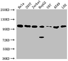 Western Blot Positive WB detected in: Hela whole cell lysate, 293T whole cell lysate, Jurkat whole cell lysate, HepG2 whole cell lysate, U87 whole cell lysate, A549 whole cell lysate, LO2 whole cell lysate All lanes: ADAR antibody at 1:2000 Second...