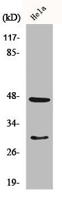 Western Blot analysis of K562 cells using Cathepsin D Polyclonal Antibody