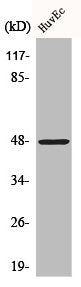 Western Blot analysis of HepG2 cells using Cathepsin E Polyclonal Antibody
