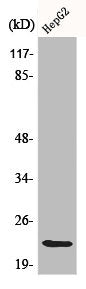 Western Blot analysis of HepG2 cells using Caveolin-1 Polyclonal Antibody