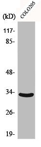 Western Blot analysis of COLO205 cells using CB2 Polyclonal Antibody