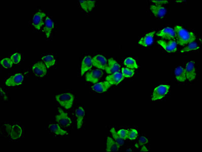 Immunofluorescence staining of Hela cells with CSB-PA001341LA01HU at 1:33, counter-stained with DAPI. The cells were fixed in 4% formaldehyde, permeabilized using 0.2% Triton X-100 and blocked in 10% normal Goat Serum. The cells were then incubate...