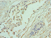 Immunohistochemistry of paraffin-embedded human prostate tissue using CSB-PA001348ESR1HU at dilution of 1:100