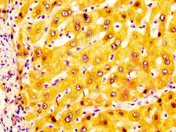 IHC image of CSB-PA001353LA01HU diluted at 1:200 and staining in paraffin-embedded human liver tissue performed on a Leica BondTM system. After dewaxing and hydration, antigen retrieval was mediated by high pressure in a citrate buffer (pH 6.0). S...