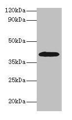 Western blot All lanes: ADH1B antibody at 2µg/ml + HepG2 whole cell lysate Secondary Goat polyclonal to rabbit IgG at 1/15000 dilution Predicted band size: 40, 36 kDa Observed band size: 40 kDa
