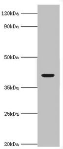Western blot All lanes: Alcohol dehydrogenase 4 antibody at 2ug/ml + Mouse liver tissue Secondary Goat polyclonal to rabbit IgG at 1/10000 dilution Predicted band size: 41, 43 kDa Observed band size: 41 kDa
