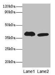 Western blot All lanes: Adh5 antibody at 2µg/ml Lane 1: Mouse liver tissue Lane 2: Mouse kidney tissue Secondary Goat polyclonal to rabbit IgG at 1/10000 dilution Predicted band size: 40 kDa Observed band size: 40 kDa