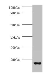Western blot All lanes: V-type proton ATPase subunit G 1 antibody at 2µg/ml + 293T whole cell lysate Secondary Goat polyclonal to rabbit IgG at 1/15000 dilution Predicted band size: 14 kDa Observed band size: 14 kDa