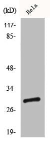 Western Blot analysis of HeLa cells using CBP 35 Polyclonal Antibody