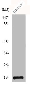 Western Blot analysis of COLO205 cells using CBP20 Polyclonal Antibody