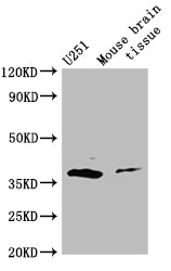 Western Blot Positive WB detected in: Mouse brain tissue All lanes: ADORA2B antibody at 3ug/ml Secondary Goat polyclonal to rabbit IgG at 1/50000 dilution Predicted band size: 37 kDa Observed band size: 37 kDa