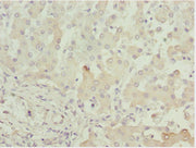 Immunohistochemistry of paraffin-embedded human liver tissue using CSB-PA001380ESR1HU at dilution of 1:100