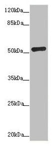 Western blot All lanes: ADPGK antibody at 1.02µg/ml + Hela whole cell lysate Secondary Goat polyclonal to rabbit IgG at 1/10000 dilution Predicted band size: 55, 54, 29, 25, 39, 9 kDa Observed band size: 54 kDa