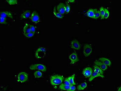 Immunofluorescent analysis of MCF-7 cells using CSB-PA001388LA01HU at dilution of 1:100 and Alexa Fluor 488-congugated AffiniPure Goat Anti-Rabbit IgG(H+L)