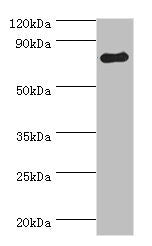 Western blot All lanes: ADRBK1 antibody at 3ug/ml + Mouse brain tissue Secondary Goat polyclonal to rabbit IgG at 1/10000 dilution Predicted band size: 80 kDa Observed band size: 80 kDa
