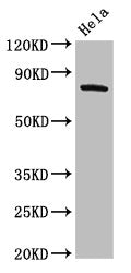 Western Blot Positive WB detected in: Hela whole cell lysate All lanes: GRK3 antibody at 2ug/ml Secondary Goat polyclonal to rabbit IgG at 1/50000 dilution Predicted band size: 80 kDa Observed band size: 80 kDa