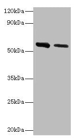 Western blot All lanes: ADSL antibody at 2µg/ml Lane 1: Hela whole cell lysate Lane 2: Mouse heart tissue Secondary Goat polyclonal to rabbit IgG at 1/10000 dilution Predicted band size: 55, 49 kDa Observed band size: 55 kDa