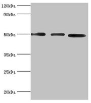 Western blot All lanes: Adenylosuccinate synthetase isozyme 2 antibody at 12ug/ml Lane 1: Mouse skeletal muscle tissue Lane 2: HepG2 whole cell lysate Lane 3: K562 whole cell lysate Secondary Goat polyclonal to rabbit IgG at 1/10000 dilution Predi...