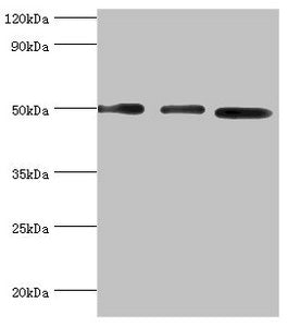 Western blot All lanes: Adenylosuccinate synthetase isozyme 2 antibody at 12ug/ml Lane 1: Mouse skeletal muscle tissue Lane 2: HepG2 whole cell lysate Lane 3: K562 whole cell lysate Secondary Goat polyclonal to rabbit IgG at 1/10000 dilution Predi...