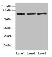 Western blot All lanes: Afp antibody at 10µg/ml Lane 1: HepG2 whole cell lysate Lane 2: Rat liver tissue Lane 3: 293T whole cell lysate Secondary Goat polyclonal to rabbit IgG at 1/10000 dilution Predicted band size: 68 kDa Observed band size: 68 kDa