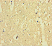 Immunohistochemistry of paraffin-embedded human brain tissue using CSB-PA001422LA01HU at dilution of 1:100