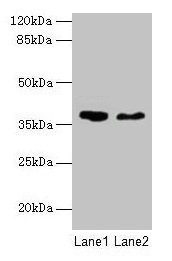 Western blot All lanes: AGA antibody at 10µg/ml Lane 1: 293T whole cell lysate Lane 2: Mouse muscle tissue Secondary Goat polyclonal to rabbit IgG at 1/10000 dilution Predicted band size: 38 kDa Observed band size: 38 kDa