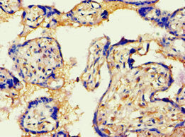 Immunohistochemistry of paraffin-embedded human placenta tissue using CSB-PA001444ESR1HU at dilution of 1:100